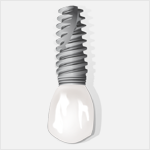 implant